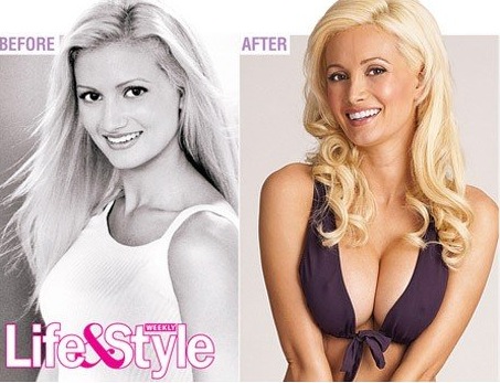 Holly Madison: Plastic Surgery Saved My Career