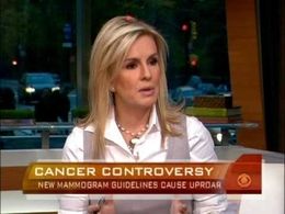 New mammogram recommendations don’t out most women at increased risk