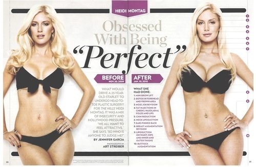 Heidi Montag’s Big Plastic Surgery Reveal: Is This a Human Anymore?