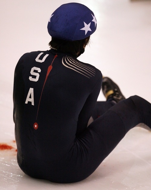 Is Ice Skating the Bloodiest Sport Ever?