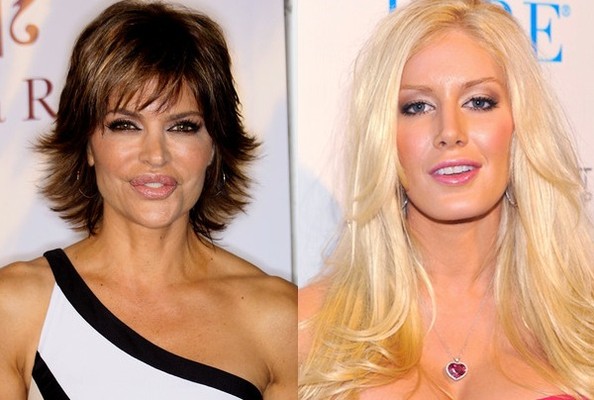 Lisa Rinna Apologizes to Heidi Montag for Plastic Surgery Comments