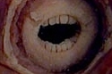 Squid With Human Teeth